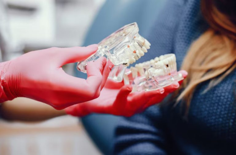 Dental Crown Vienna: Sustainable solutions for damaged teeth
